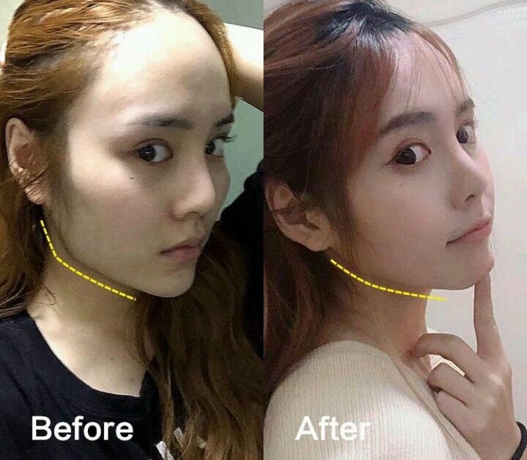 {杭州连天美医疗美容医院怎么样