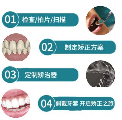 西安新城团圆口腔医院（西安总院）详细的预约挂号方式及流程