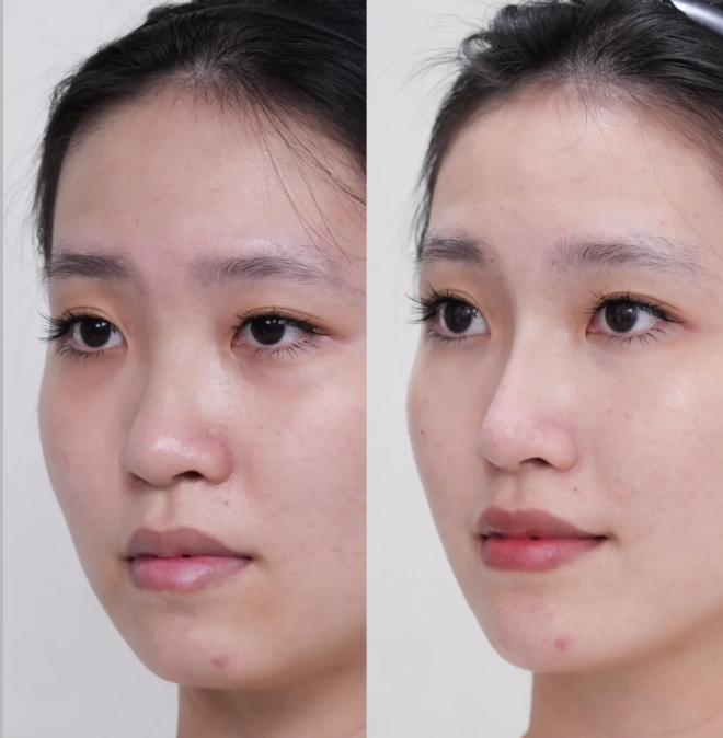 四川成都美容整形医院私密科真人口碑评价怎么样？