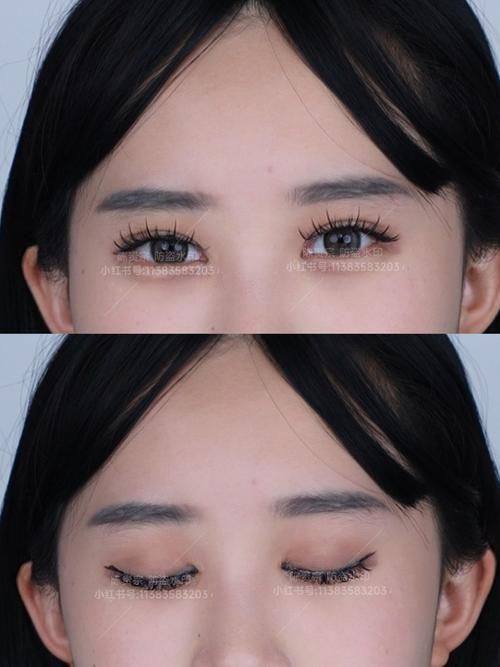 成都川美整形医疗美容诊所是正规医院吗？