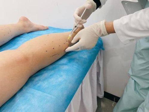 北京伊芙丽格医疗美容医院详细的预约挂号方式及流程