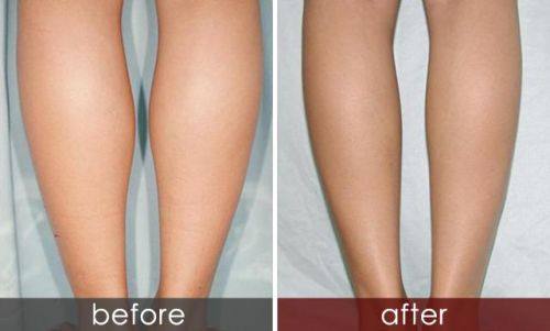 北京伊芙丽格医疗美容医院真人口碑评价怎么样？