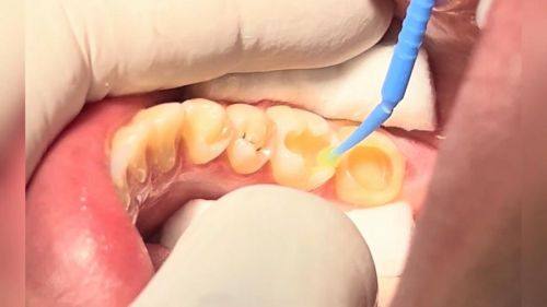 成都华品口腔收费价格表/收费标准