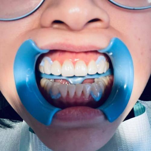 成都华品口腔真人口碑评价怎么样？