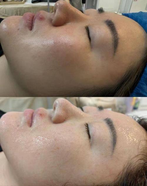 北京伊芙丽格医疗美容医院是正规医院吗？