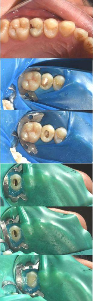 渭南雅益口腔门诊部收费价格表/收费标准