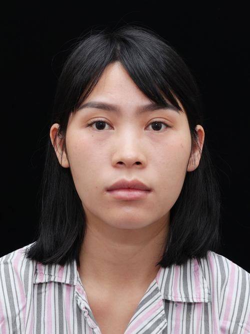 沈阳玛尔诗整形医院收费价格表/收费标准