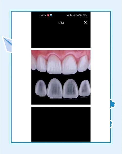 渭南雅益口腔门诊部真人口碑评价怎么样？