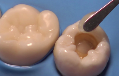 山东威海刘杰口腔详细的预约挂号方式及流程