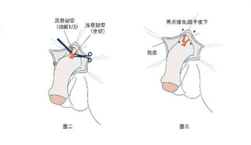 珠海六和整形美容医院特色项目及技术优势
