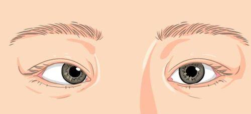 山西太原爱维视眼科特色项目及技术优势