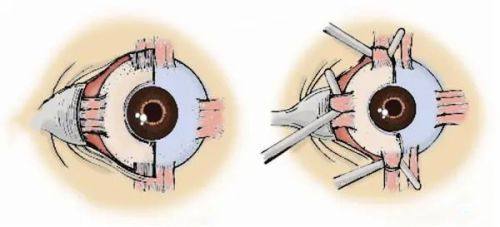 山西太原爱维视眼科医生团队实力强大及骨干医生简介