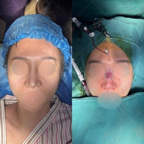 重庆天妃整形医院详细的预约挂号方式及流程