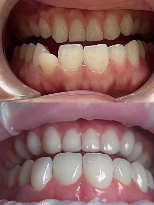 秦金铭口腔详细的预约挂号方式及流程