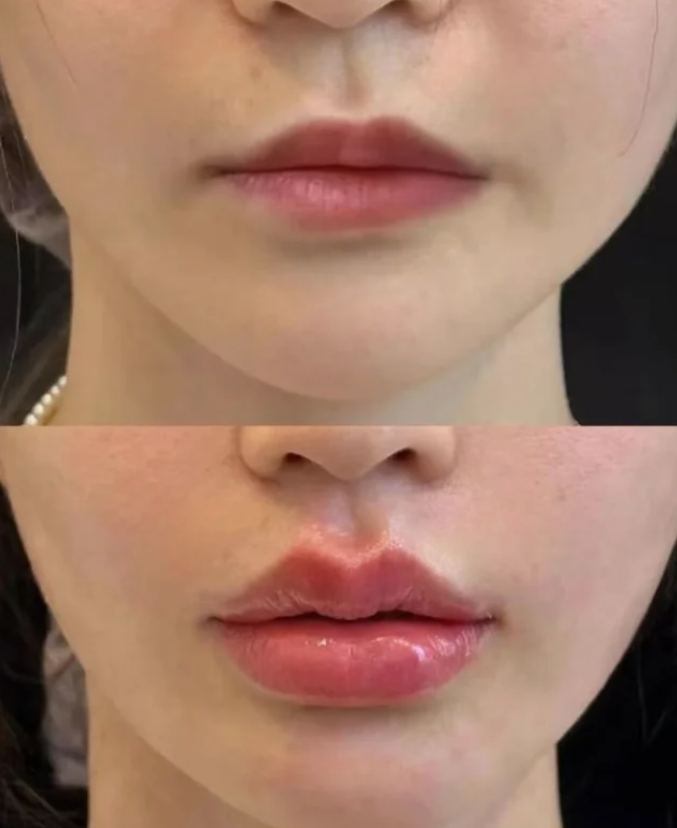 韩国Lyhn整形外科是正规医院吗？