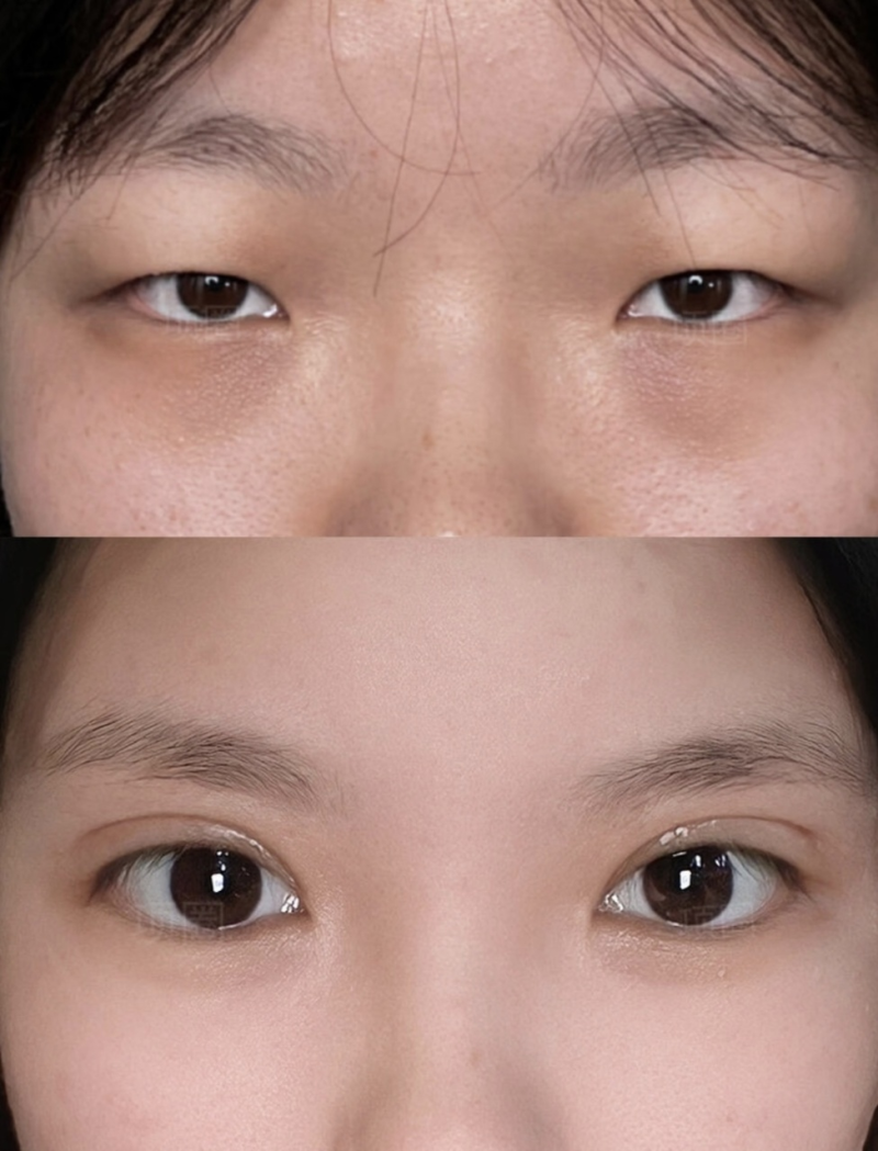 韩国Lyhn整形外科特色项目及技术优势