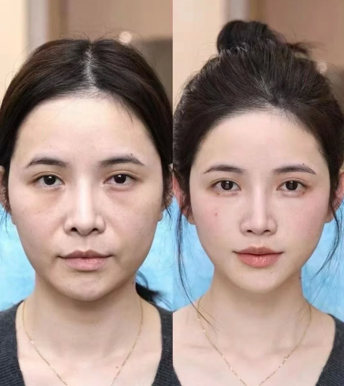 珠海六和整形美容医院是正规医院吗?