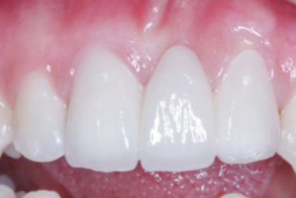 秦金铭口腔真人口碑评价怎么样?