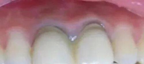 欢乐仁爱口腔(皇寺广场店)真人口碑评价怎么样?