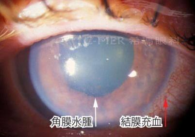 保定市第二中 心医院眼科详细的预约挂号方式及流程