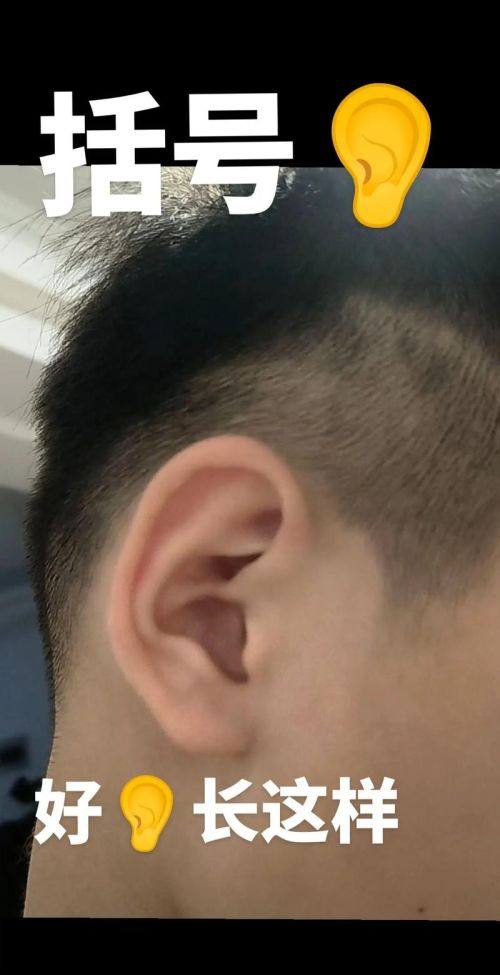 杭州美立方整形美容医院真人口碑评价怎么样?