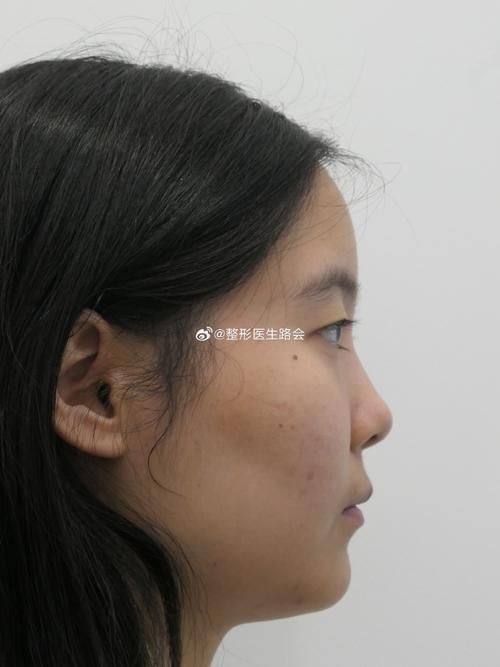 杭州美立方整形美容医院是正规医院吗?