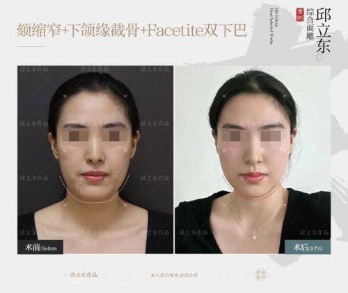 杭州美立方整形美容医院详细的预约挂号方式及流程