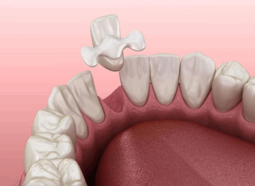 欢乐仁爱口腔(皇寺广场店)特色项目及技术优势