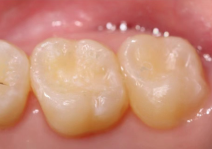 欢乐仁爱口腔(皇寺广场店)收费价格表/收费标准