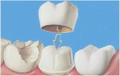 贵州贵阳龅牙兔口腔收费价格表/收费标准
