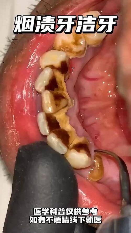 徐州医 科汇美口腔科真人口碑评价怎么样?