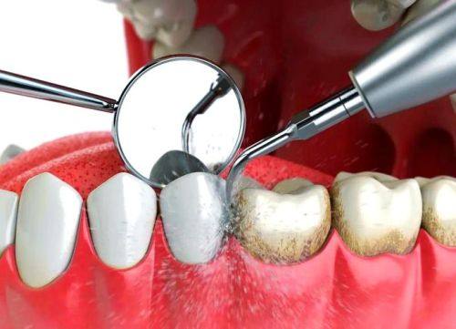 徐州医 科汇美口腔科详细的预约挂号方式及流程