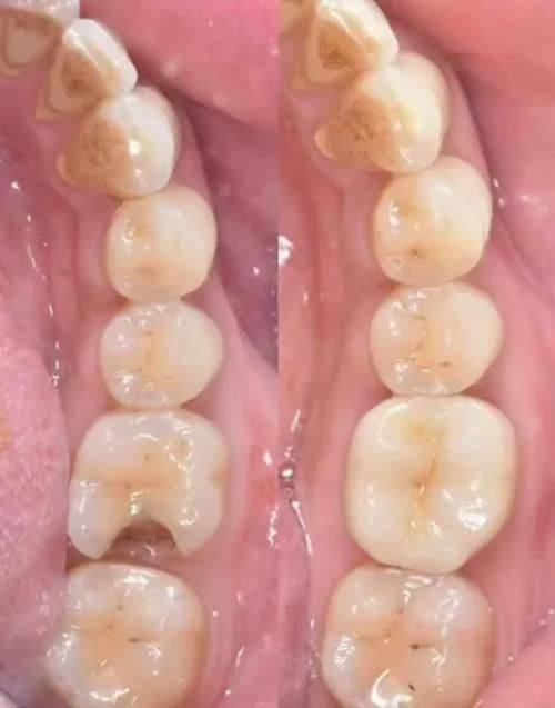 徐州医 科汇美口腔科地址电话营业时间