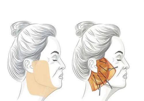 哈尔滨光谱医疗美容门诊部是正规医院吗?