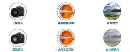 曲靖市第二人民医院眼科详细的预约挂号方式及流程