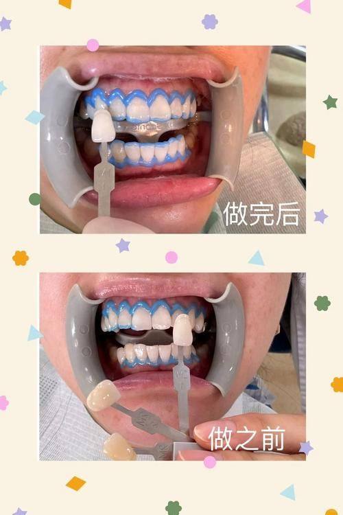 德州伊恩口腔诊所真人口碑评价怎么样？