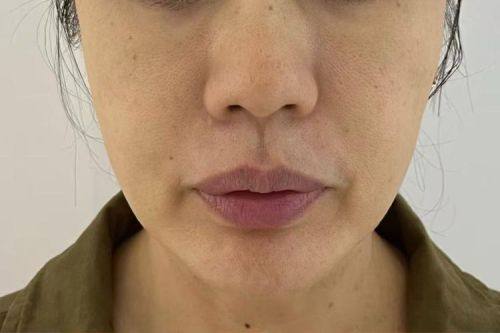 泉州皮肤病防治院整形科收费价格表/收费标准