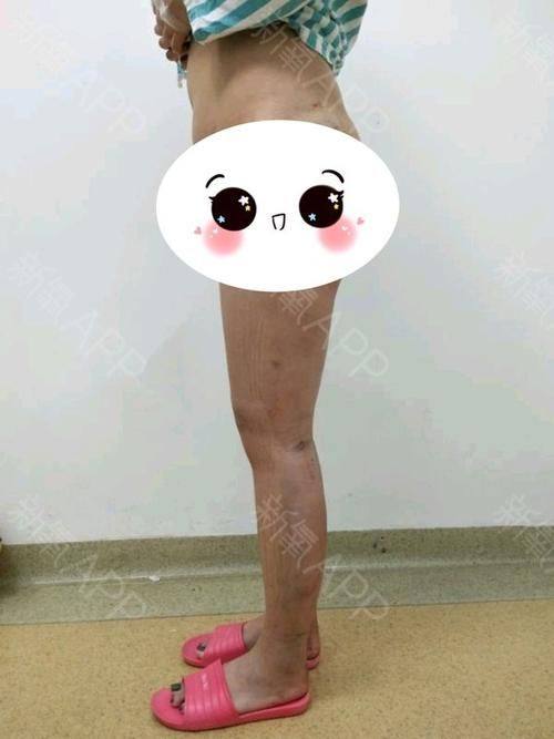 泉州皮肤病防治院整形科详细的预约挂号方式及流程