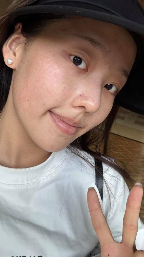 泉州皮肤病防治院整形科真人口碑评价怎么样？