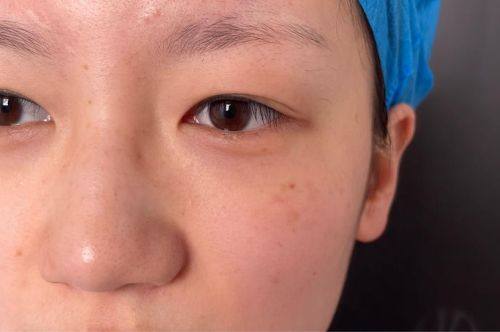 泉州皮肤病防治院整形科特色项目及技术优势