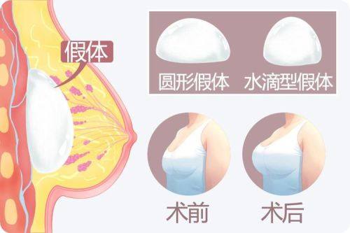 内蒙古佳丽整形医疗美容诊所真人口碑评价怎么样？