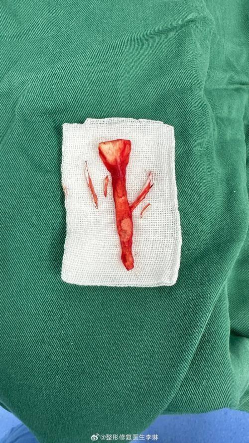 内蒙古佳丽整形医疗美容诊所是正规医院吗？