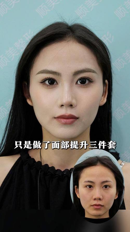 哈尔滨光谱医疗美容门诊部收费价格表/收费标准