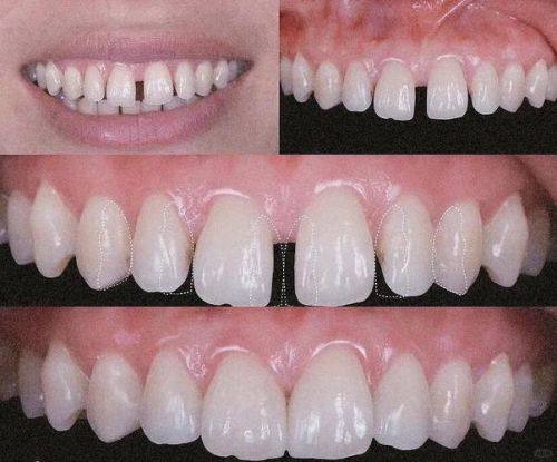 深圳美博森口腔(上塘分院)是正规医院吗?