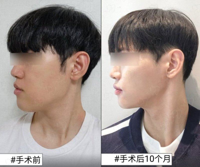 泉州皮肤病防治院整形科是正规医院吗？