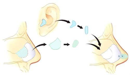 玉林市红十字会医院整形科是正规医院吗？