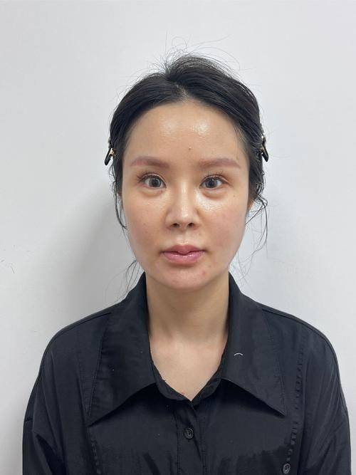 南宁科医美医疗整形美容详细的预约挂号方式及流程