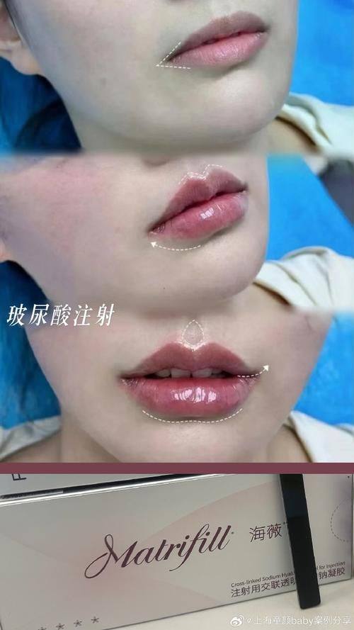 玉林市红十字会医院整形科收费价格表/收费标准