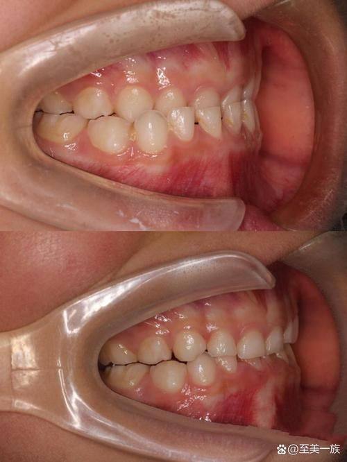 昆明维密欧贝丽口腔门诊特色项目及技术优势