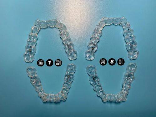 昆明维密欧贝丽口腔门诊真人口碑评价怎么样？